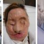Charla Nash face transplant: first photo published