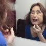 Connie Culp: her life after face transplant. US first face transplant.