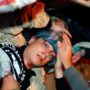 Occupy Oakland: Scott Olsen, an Iraq veteran hospitalized in serious condition.