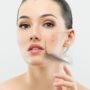 Breakthrough gel treats middle-age acne (rosacea) in four weeks