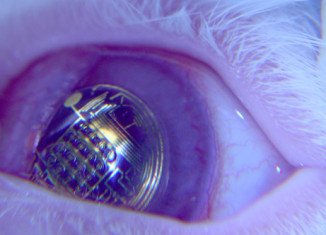 A bionic eye which is powered by light has been invented by scientists at Stanford University in California