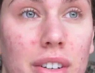 Cassandra Bankson posted a video on YouTube showing her red and blemished skin before applying make-up and how she managed to make her face look flawless in just ten minutes thanks to her beauty tricks
