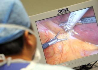 Doctors from St Thomas’ hospital in London are trialling "touchless" technology, often used in TV games, to help them carry out delicate keyhole surgery