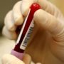 US baby boomers advised to get tested for hepatitis C