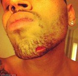 Chris Brown posted a picture of a gash on his chin, apparently sustained from the fight with Drake