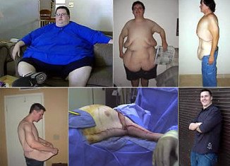 David Smith revealed yesterday that he is once again morbidly obese, having re-gained over 250 of the 400 lbs he lost