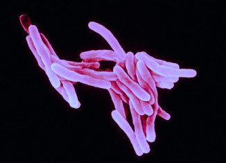 A new study showed three drugs given in combination killed more than 99 percent of TB bacteria after two weeks of treatment