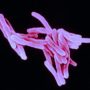 More effective tuberculosis treatment hope