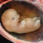 Smoking women’ embryos grow more slowly