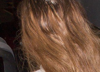 Lindsay Lohan flashed a big bald patch at the back of her head by her crown