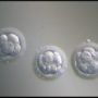 Embryo genetic testing during IVF treatment is safe