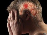 Clots block blood vessels, starving parts of the brain of oxygen, which leads to symptoms such as paralysis and loss of speech