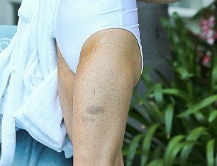 Lindsay Lohan’s eye-catching look was tainted by blotchy fake tan, which was particularly noticeable around her armpit