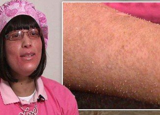 Shanyna Isom has been labelled a medical mystery after falling victim to an unidentified illness which causes human nails to grow out of her hair follicles