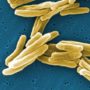 Vitamin D may help treat deadly tuberculosis