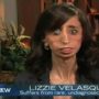 Lizzie Velasquez, world’s ugliest woman, releases second book about her struggle to be accepted