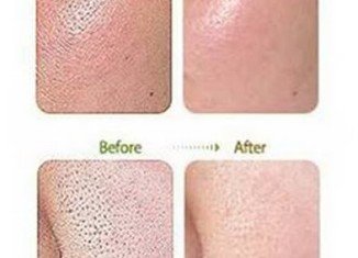 Before and after BB cream treatment