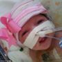Audrina Cardenas, the baby girl born with ectopia cordis, recovering after life-saving surgery