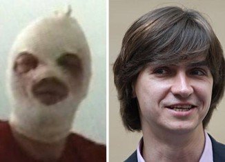 Sergei Filin's eyesight was damaged when a masked attacker threw sulphuric acid in his face