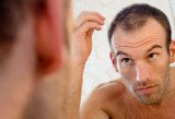 A Japanese study of nearly 37,000 people said balding men were 32 percent more likely to have coronary heart disease