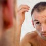 Balding men are more likely to have coronary heart disease