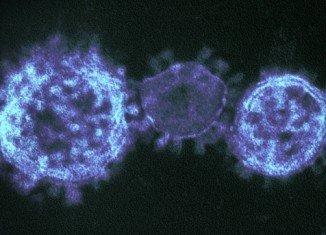 French health ministry confirmed a second man contracted the new coronavirus in a possible case of human-to-human transmission