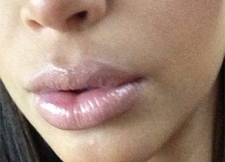 Kim Kardashian shares a picture of her plumped-up pout