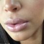 Kim Kardashian pregnancy lips