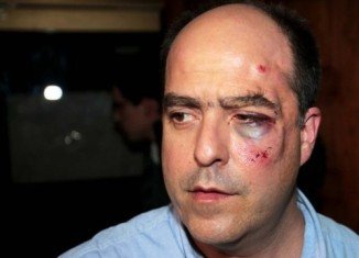 Opposition deputy Julio Borges appeared on a local TV station with facial bruises after Venezuela’s parliament brawl