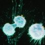 Ovarian cancer screening shows potential