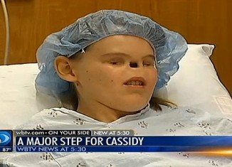 Cassidy Hooper, who was born with no eyes or nose, is just days away from a surgery that will give her a nose