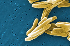 Tuberculosis originated among human 70,000 years ago and 