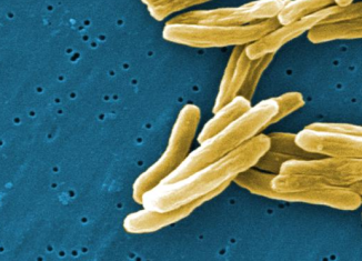 The origins of human tuberculosis have been traced back to hunter-gatherer groups in Africa 70,000 years ago