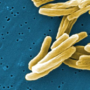 Tuberculosis origins traced back to humans