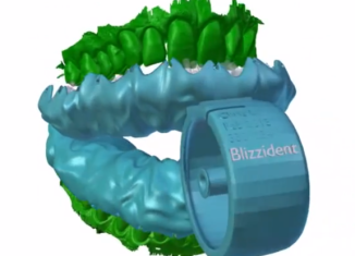 Blizzident toothbrush can clean teeth thoroughly in less than six seconds