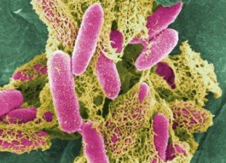 Food poisoning bacterium Clostridium perfringens may be implicated in Multiple sclerosis