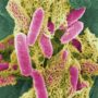 Multiple sclerosis linked to food poisoning bacterium Clostridium perfringens