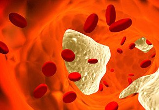 HDL cholesterol also has a nasty side that can increase the risk of heart attacks