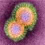 MERS virus: CDC confirms second imported case