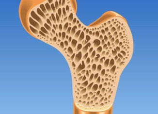 Osteogenesis Imperfecta is an inherited condition, where abnormalities in the genes controlling collagen affect the bone's strength