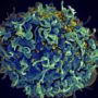 Early HIV treatment may not cure virus