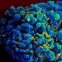 US HIV infection rate decreases by 33.2% from 2002 to 2011