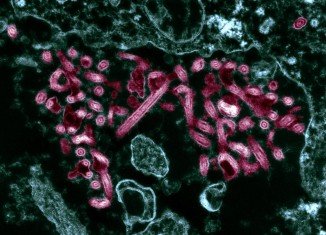 The Ebola virus spreads by contact with infected blood and bodily fluids