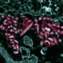 Ebola outbreak: Suspected patient dies in Saudi Arabia