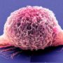 Bladder cancer breakthrough: New immunotherapy drug for terminal patients