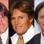 Bruce Jenner gets a nose surgery to look more feminine
