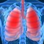 Cystic Fibrosis: New Therapy Profoundly Improves Quality of Life