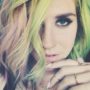 Kesha’s Sony Music Slavery Case Dismissed by New York Court