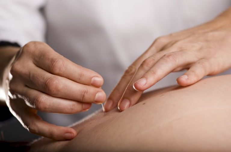 Helpful Information Regarding Infertility and Acupuncture Therapy