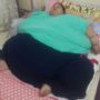 World’s Fattest Woman Undergoes Weight Loss Surgery in Mumbai